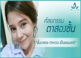 ศัลยกรรมตาสองชั้น