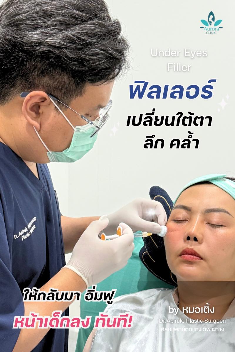 ฟิลเลอร์...ไม่ใช่แค่เรื่องของ "อายุ" ฟิลเลอร์...ไม่ใช่แค่เรื่องของ "อายุ"